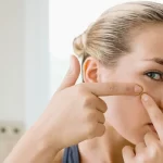 Pimple Poppers Video