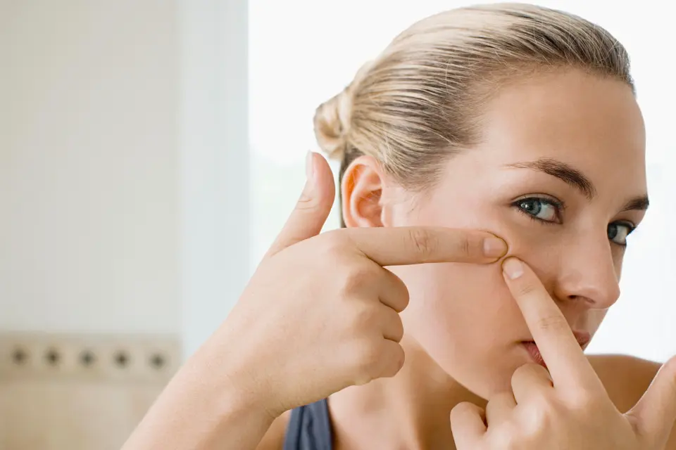 Pimple Poppers Video Pimple Poppers Video